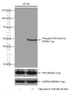 Phospho-P53 (Ser15) Monoclonal antibody proteintech 67826-1-Ig