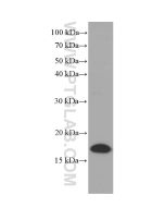 Lysozyme Monoclonal antibody proteintech 66456-1-Ig