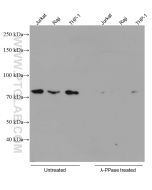 Phospho-RIPK1 (Ser161)  Monoclonal antibody proteintech 66854-1-Ig