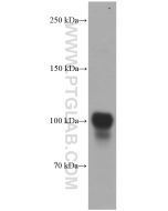 PSMA/GCPII Monoclonal antibody proteintech 66678-1-Ig