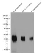 ICAM4 Monoclonal antibody proteintech 67014-1-Ig