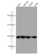 GRP94 Monoclonal antibody proteintech 60012-2-Ig