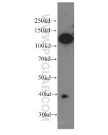 CD146/MCAM Monoclonal antibody proteintech 66153-1-Ig