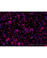 Anti-Human CD107b / LAMP2 (H4B4) proteintech 65053-1-Ig