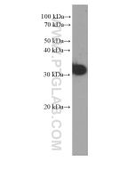 CD99 Monoclonal antibody proteintech 60354-1-Ig