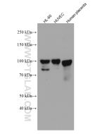 Endoglin/CD105 Monoclonal antibody proteintech 67075-1-Ig