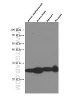 MYL3 Monoclonal antibody proteintech 66286-1-Ig