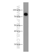 Transferrin/TF Monoclonal antibody proteintech 66171-1-Ig