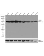 LPCAT1 Monoclonal antibody proteintech 66044-1-Ig