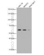 p57Kip2 Monoclonal antibody proteintech 66794-1-Ig
