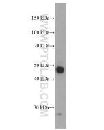 PD-L1/CD274 Monoclonal antibody proteintech 66248-1-Ig