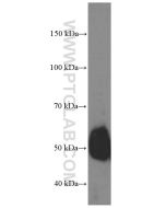 GATA3 Monoclonal antibody proteintech 66400-1-Ig