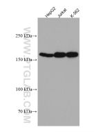 Thrombospondin 1 Monoclonal antibody proteintech 67241-1-Ig
