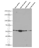 Chk1 Monoclonal antibody proteintech 60277-1-Ig