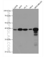 CYR61/CCN1 Monoclonal antibody proteintech 67656-1-Ig