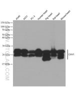 Caveolin-1 Monoclonal antibody proteintech 66067-1-Ig