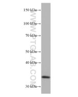 EHF Monoclonal antibody proteintech 67125-1-Ig