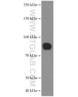 CD36 Monoclonal antibody proteintech 66395-1-Ig