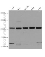 CIP2A Monoclonal antibody proteintech 67843-1-Ig