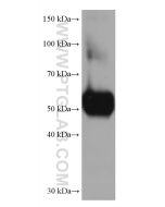 Angiotensinogen/AGT Monoclonal antibody proteintech 68020-1-Ig