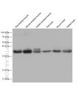 TPM4 Monoclonal antibody proteintech 67244-1-Ig