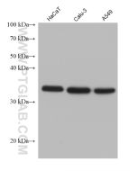 CXCL16 Monoclonal antibody proteintech 60123-1-Ig