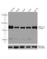 FOXO3A Monoclonal antibody proteintech 66428-1-Ig