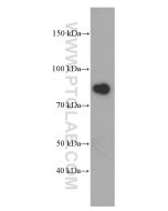 Gamma Catenin Monoclonal antibody proteintech 66445-1-Ig