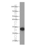 GAMT Monoclonal antibody proteintech 66322-1-Ig