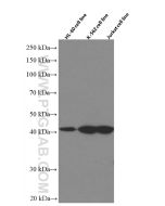 GATA1 Monoclonal antibody proteintech 60011-1-Ig