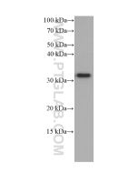 CD40L/CD154 Monoclonal antibody proteintech 66502-1-Ig