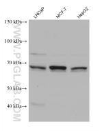 HSPA6 Monoclonal antibody proteintech 68257-1-Ig