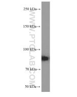 RRM1 Monoclonal antibody proteintech 60073-2-Ig