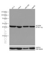 ACADM Monoclonal antibody proteintech 67742-1-Ig