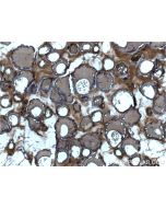 Thyroglobulin Monoclonal antibody proteintech 60272-1-Ig