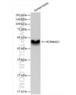 HORMAD1 Recombinant monoclonal antibody proteintech 84003-5-RR