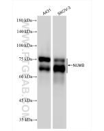 NUMB Recombinant monoclonal antibody proteintech 85939-4-RR