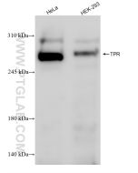 TPR Recombinant monoclonal antibody proteintech 83177-5-RR