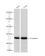 E-cadherin Recombinant monoclonal antibody proteintech 83991-4-RR
