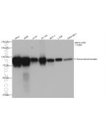 Glucocorticoid receptor Recombinant monoclonal antibody proteintech 82619-4-RR