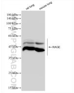 RAGE Recombinant monoclonal antibody proteintech 83742-5-RR