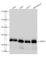 RBM10 Recombinant monoclonal antibody proteintech 84104-2-RR