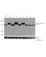 Phospho-EIF4B (Ser406) Recombinant monoclonal antibody proteintech 80059-1-RR