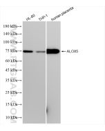 5 Lipoxygenase Recombinant monoclonal antibody proteintech 83794-4-RR