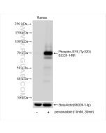 Phospho-SYK (Tyr323) Recombinant monoclonal antibody proteintech 83331-1-RR