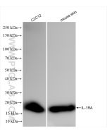 IL-1RA/IL-1RN Recombinant monoclonal antibody proteintech 85672-3-RR