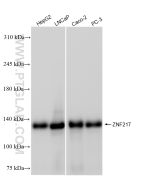 ZNF217 Recombinant monoclonal antibody proteintech 84276-1-RR