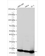 CDKN2A/P16-INK4A Recombinant monoclonal antibody proteintech 81373-10-RR