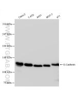 E-cadherin Recombinant monoclonal antibody proteintech 84646-4-RR