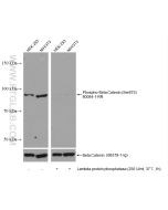 Phospho-Beta Catenin (Ser675) Recombinant monoclonal antibody proteintech 80084-1-RR